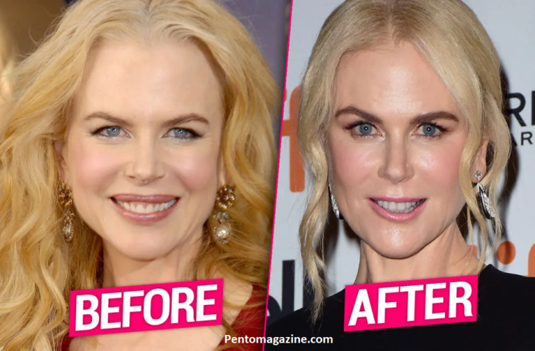 How Old Is Nicole Kidman? Truth About Her Age (2025)