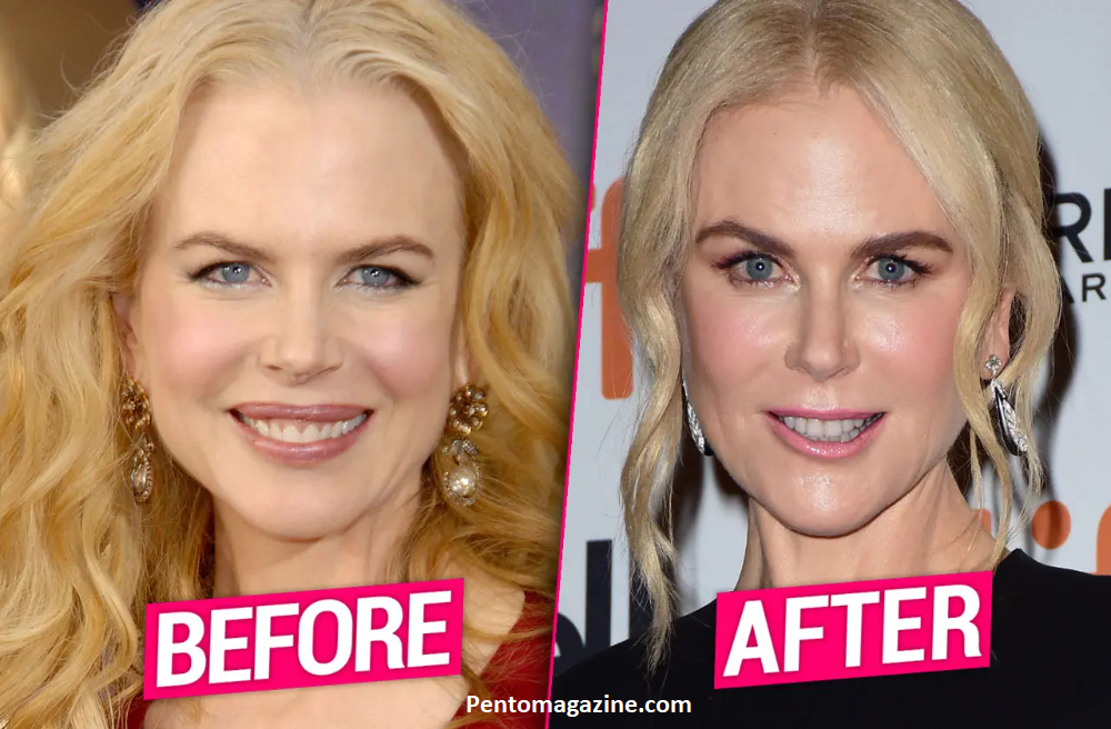How Old Is Nicole Kidman? Truth About Her Age (2025)